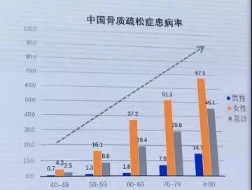 中國人骨密度從多少歲開始減少