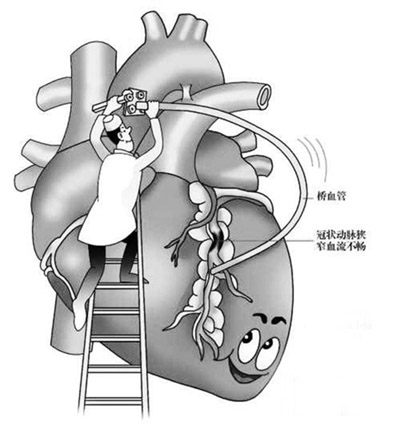 超聲骨密度測(cè)試儀